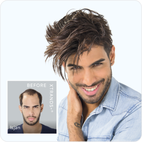 Hair Restoration California